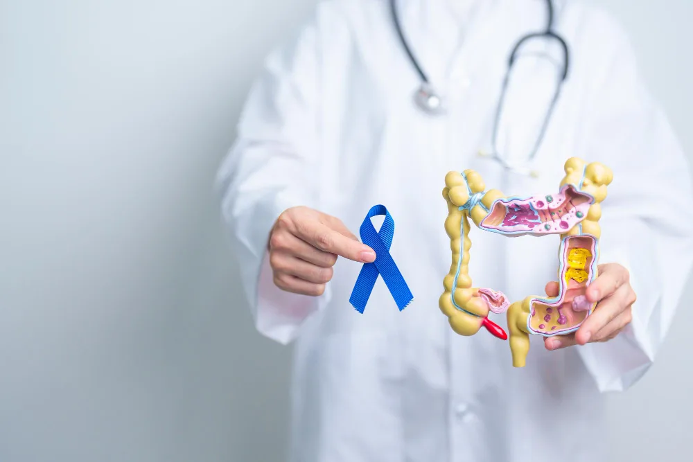 Cáncer de colon y recto en CDMX y área metropolitana: atención coloproctológica especializada